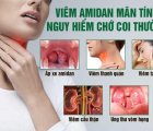 Phẫu Thuật Cắt AMIDAN – Giải Pháp Giúp Trẻ Khỏe Hơn Mỗi Ngày